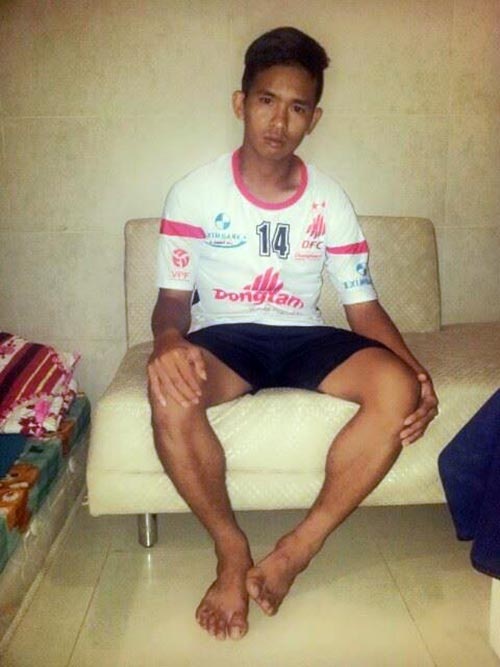 Cau thu phai cat gan o chan noi len vai vi bao luc san co hinh anh