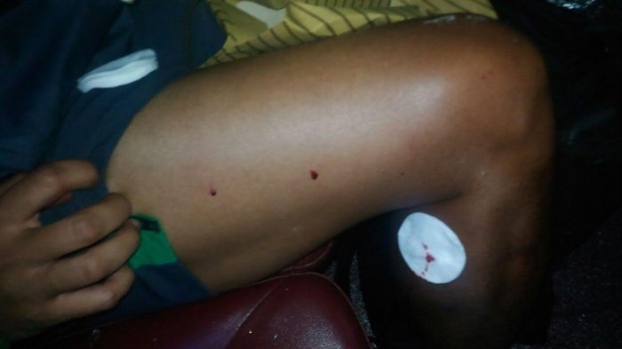 Xe cho tuyen Indonesia bi tan cong anh 5