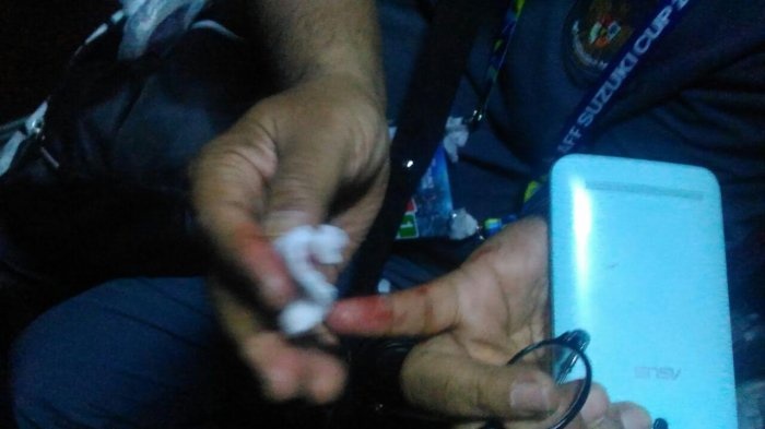 Thanh vien tuyen Indonesia do mau vi xe bus bi tan cong hinh anh