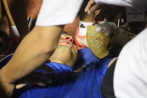 Quang Nam hoa Binh Duong 1-1 anh 2