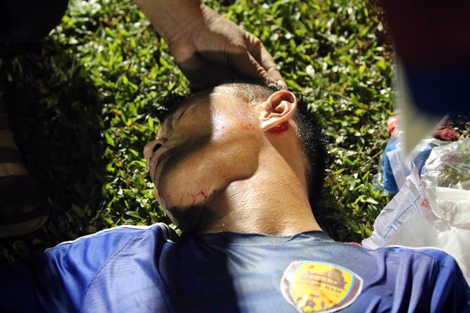 Cau thu Quang Nam do mau o tran hoa HAGL hinh anh