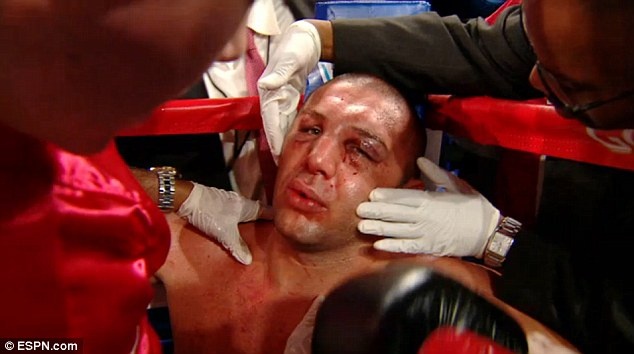 So phan bi kich cua Magomed Abdusalamov anh 2