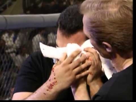 Tran dau giua Dave Beneteau va Asbel Cancio hinh anh