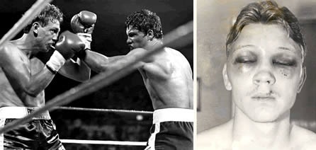 Vụ lừa bịp trong làng quyền anh ảnh 1 Vu lua bip trong lang quyen anh anh 1