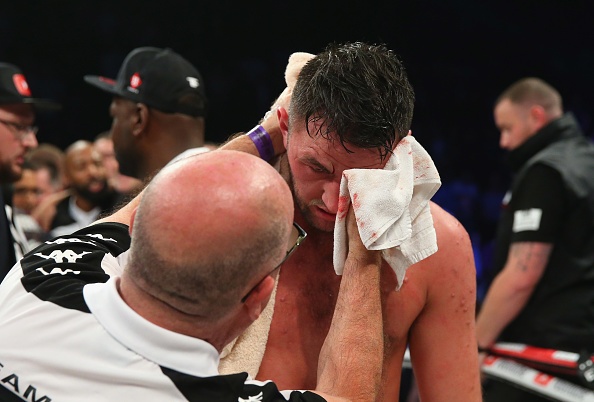 Em trai Tyson Fury thua tran dau tien anh 7