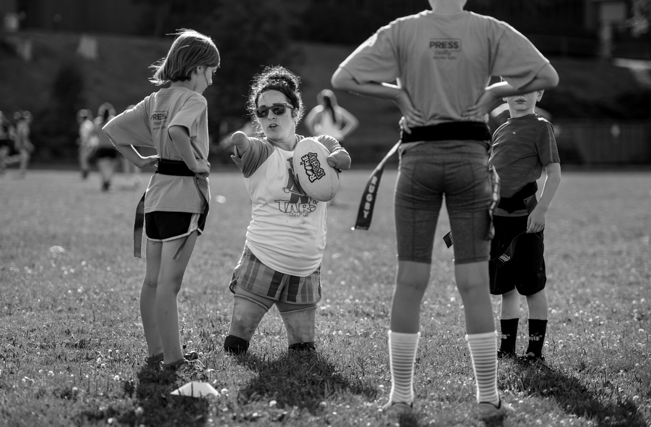 Nu VDV khong co tay chan anh 2