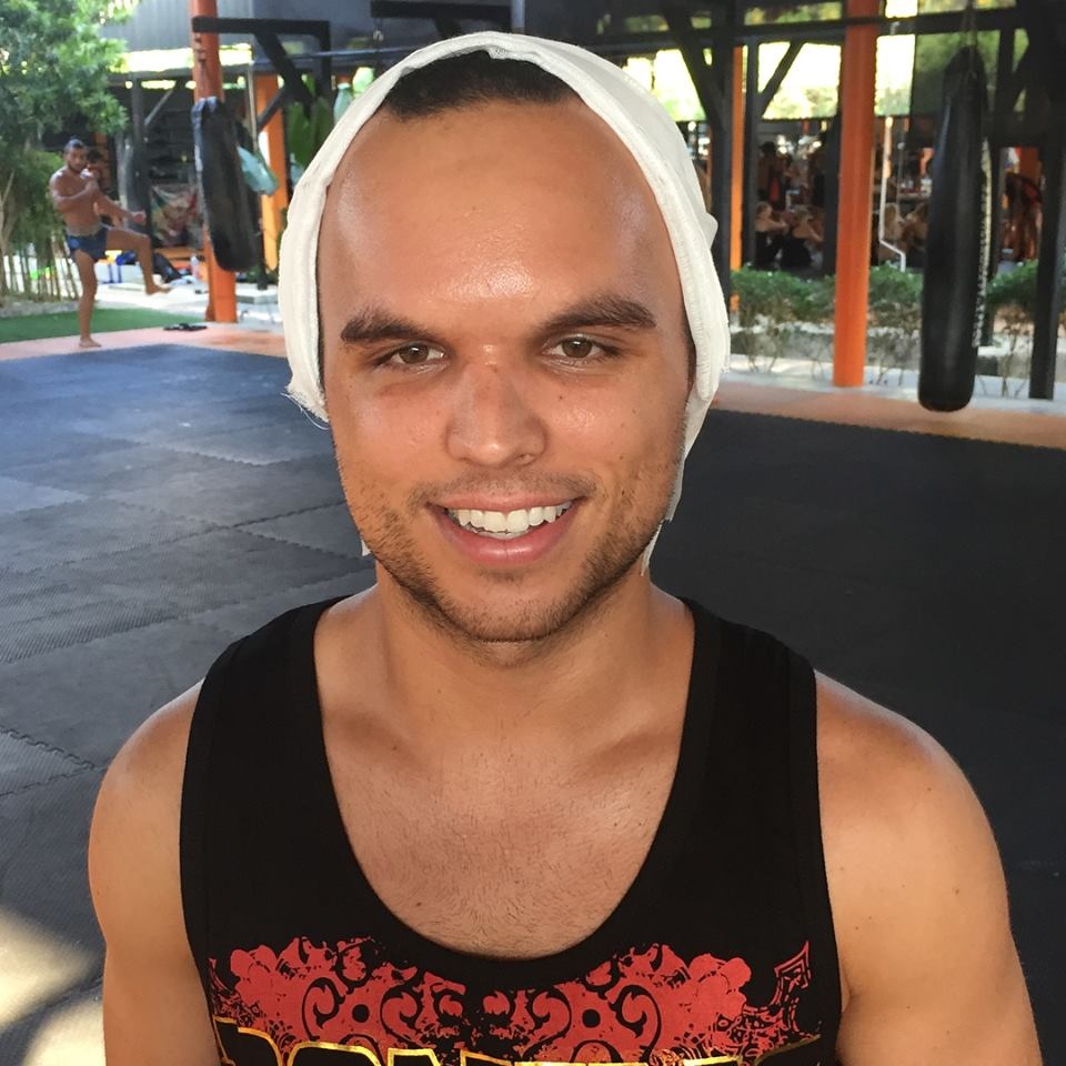 Công bố đoạn clip ghi lại cảnh võ sĩ bị lõm sọ sau đòn giật chỏ  ảnh 2 Cong bo doan clip ghi lai canh vo si bi lom so sau don giat cho anh 2