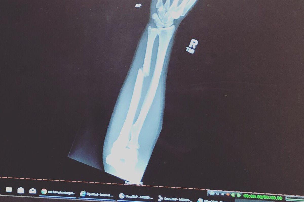 Vo si xinh dep nhat thua tran anh 5