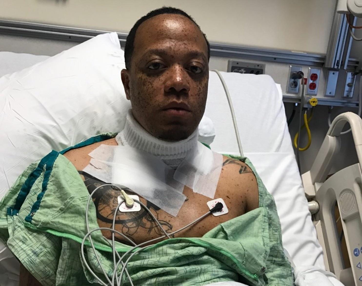 Bi dien giat khi sac iPhone qua dem hinh anh