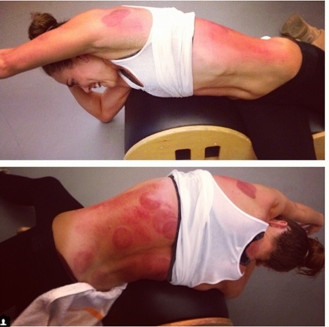 No ro trao luu giac hoi tai Olympic anh 9