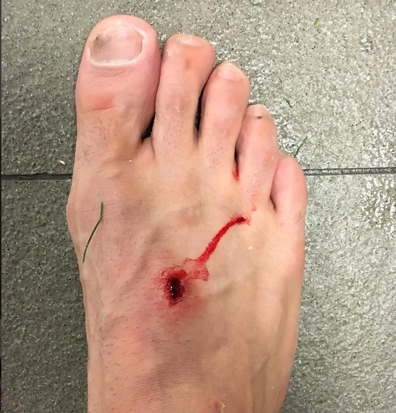 Suarez khau chien Filipe Luis anh 1