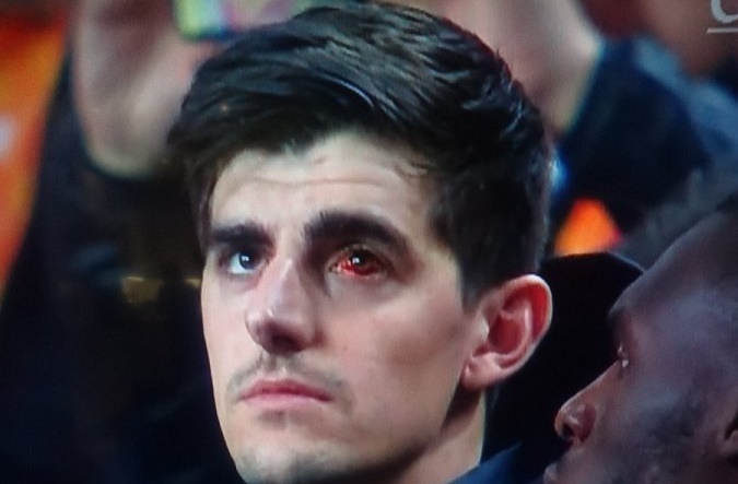 Mat trai xuat huyet, Courtois khien Chelsea lo au hinh anh