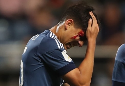 Bong da tre Argentina trong vong xoay khung hoang hinh anh