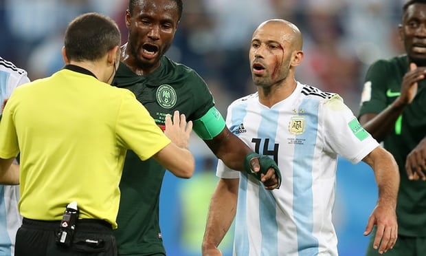 Muốn thắng Pháp, Argentina hãy nhìn gương mặt đổ máu của Mascherano mà đá ảnh 1 Muon thang Phap, Argentina hay nhin guong mat do mau cua Mascherano ma da anh 1