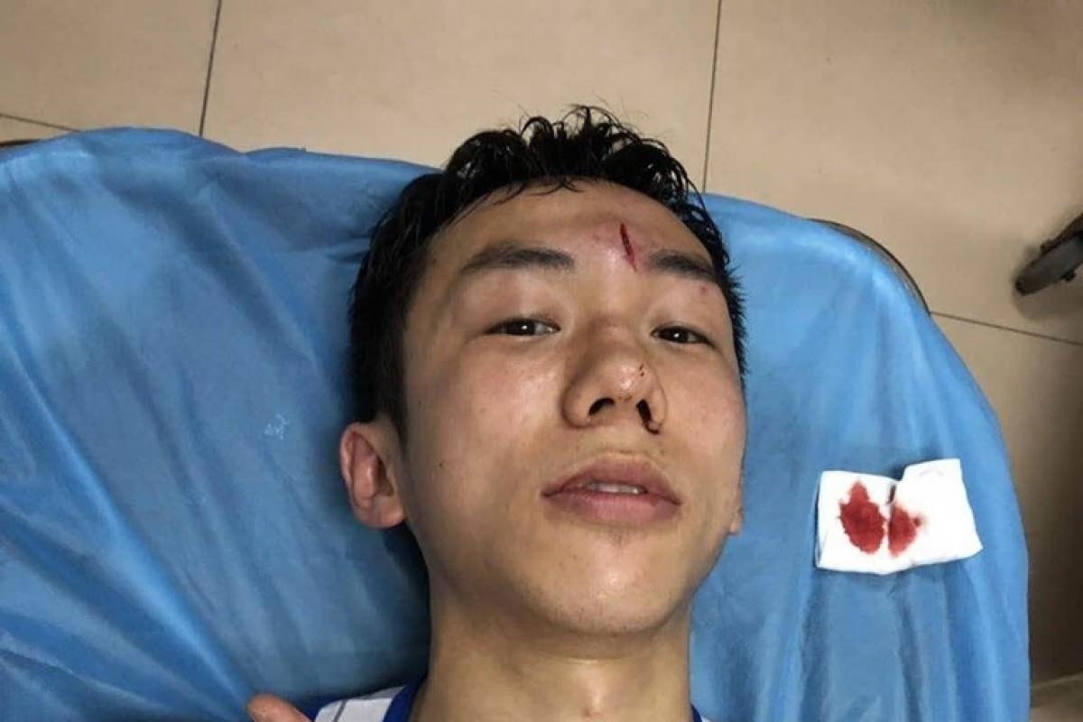 Cuu vo dich quyen anh phai khau 8 mui hinh anh