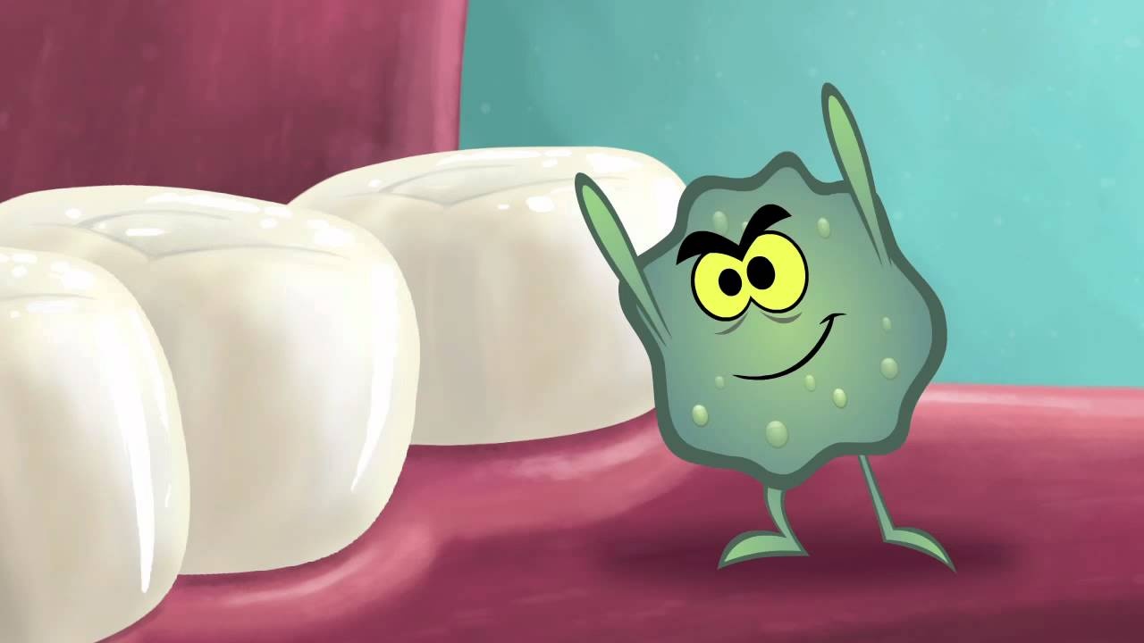 Vi khuẩn và thức ăn đọng gây ra hôi miệng.