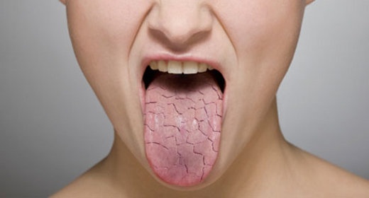 Khô miệng , cảm giác rất khó chịu.