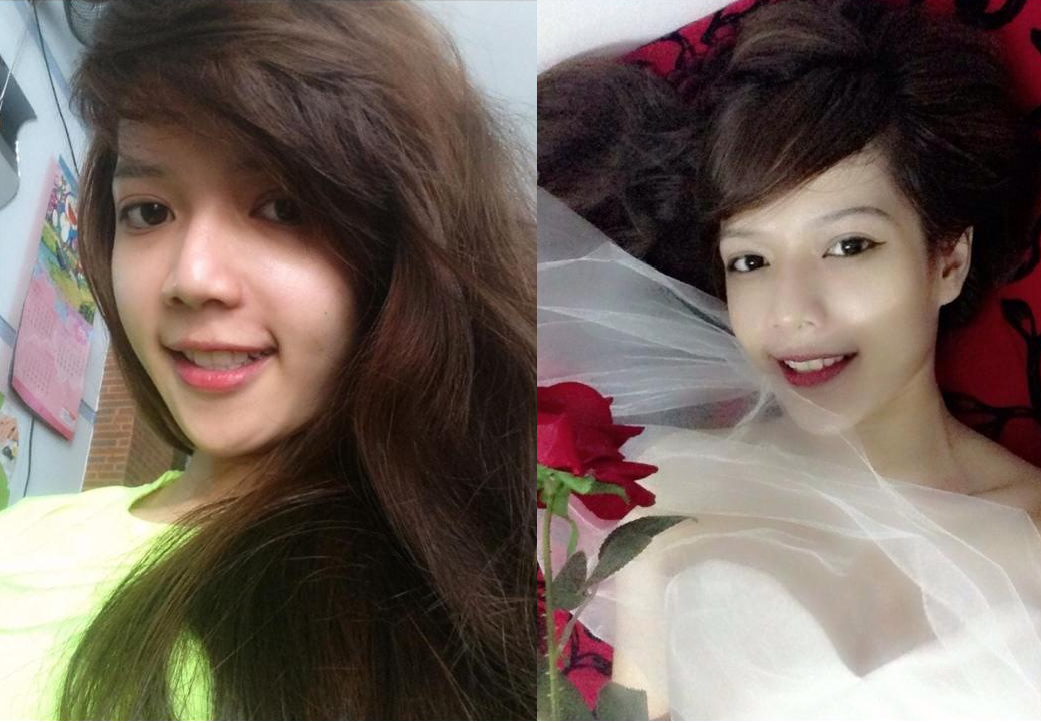 Phau thuat ham ho tai tham my Han Quoc JW hinh anh