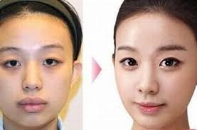 Khuon mat V line - trao luu lam dep moi hinh anh