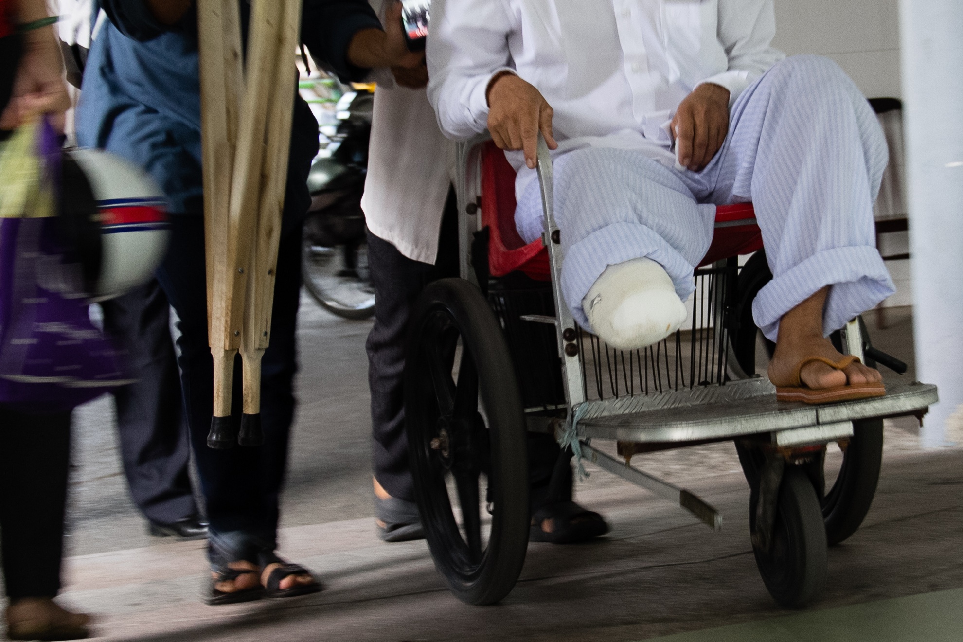 Bị mất 1 chân trong tai nạn anh Nam hết sức lo lắng cho thời gian sắp tới vì chưa biết sẽ kiếm việc như thế nào để chăm lo nuôi nấng cho con.