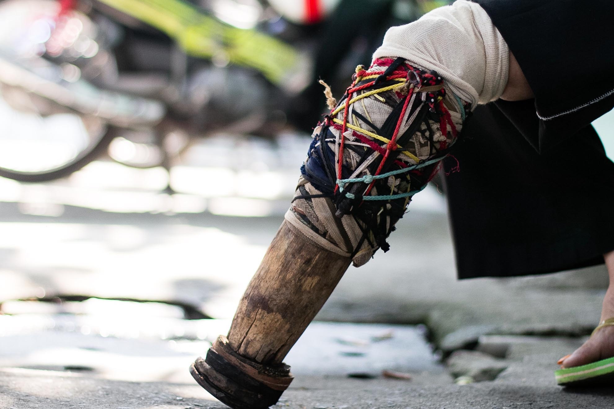 Với những người nghèo bị thương tật do tai nạn, nỗi đau không chỉ là sự mất mát một phần cơ thể mà nó còn là gánh nặng đối với gia đình họ. Bà Nguyễn Ngọc Mai ở Bà Rịa- Vũng Tàu đã phải sinh hoạt bằng đôi chân giả tự chế trong nhiều năm nay. Sáng nay bà đã rất xúc động khi ngồi chờ tới lượt để nhận chiếc chân giả mới vừa vặn và khá đẹp đối với bà.