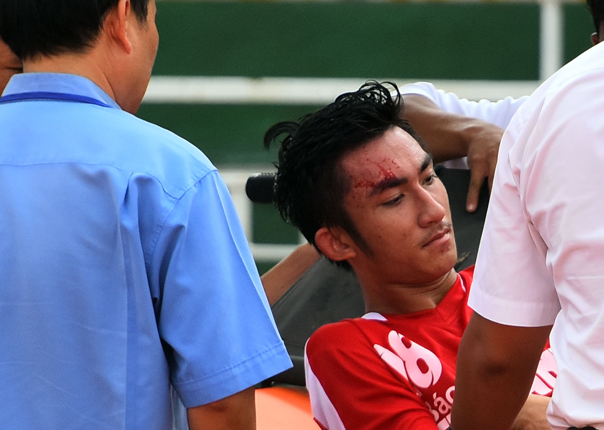 Them cau thu U21 Binh Dinh nhap vien o giai U21 Quoc gia hinh anh