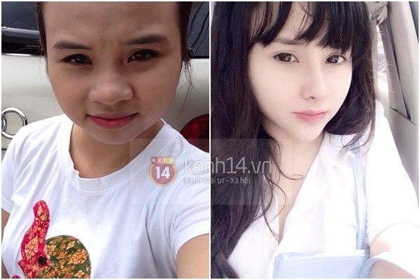 Những hình ảnh trước và sau khi phẫu thuật của Thu Trang khiến nhiều người ngỡ ngàng.