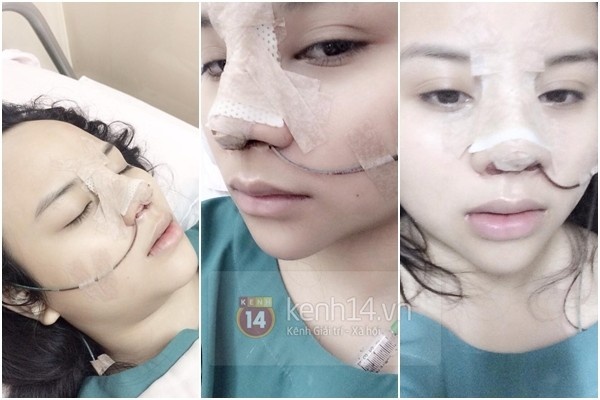 Những hình ảnh trong lúc phẫu thuật của Thu Trang.