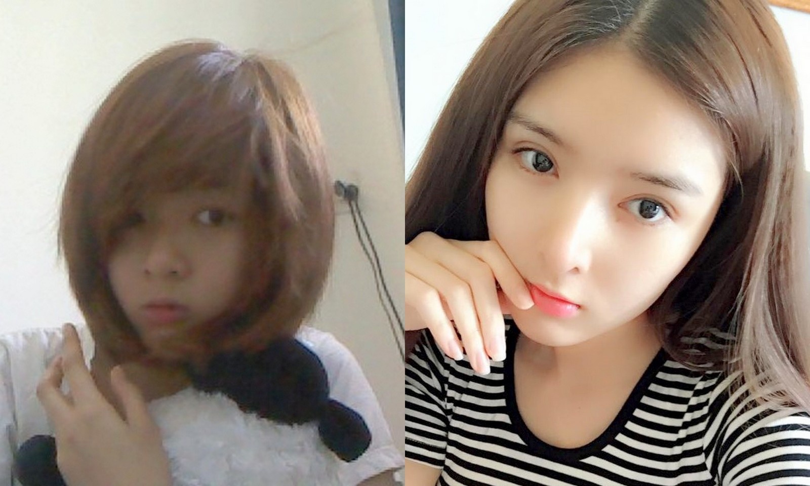 Su bien doi cua hot girl Lilly Luta sau phau thuat tham my hinh anh