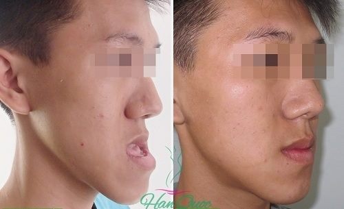 Khong khep duoc mieng, 9X mien Tay chi 80 trieu lam lai mat hinh anh