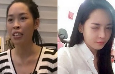 Co gai Nam Dinh khong nhan ra minh khi lot xac nho tham my hinh anh