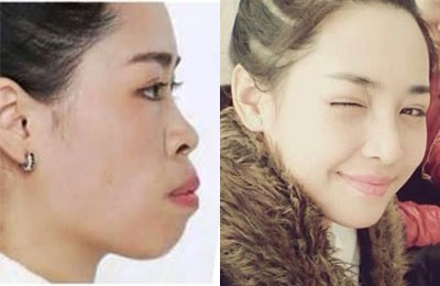 Co gai lot xac nho tham my o ND: Nhan ra con nho giong noi hinh anh