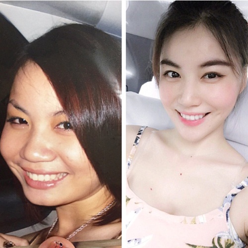 Thảo Nhi bị ghép với nhiều bức hình không được xinh xắn vì nghi án phẫu thuật thẩm mỹ.