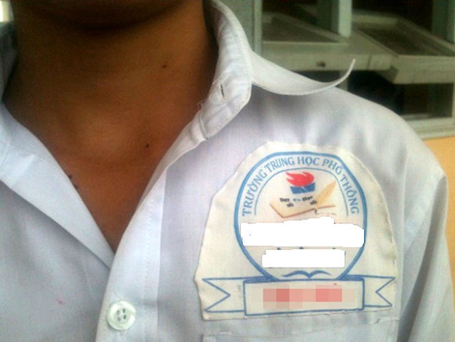 Logo truong hoc gay phien hinh anh