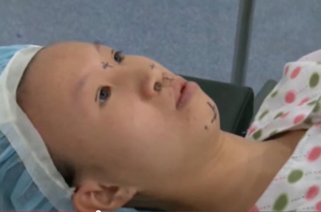 Clip bac si Han Quoc kham va phau thuat cho Nam Phuong hinh anh