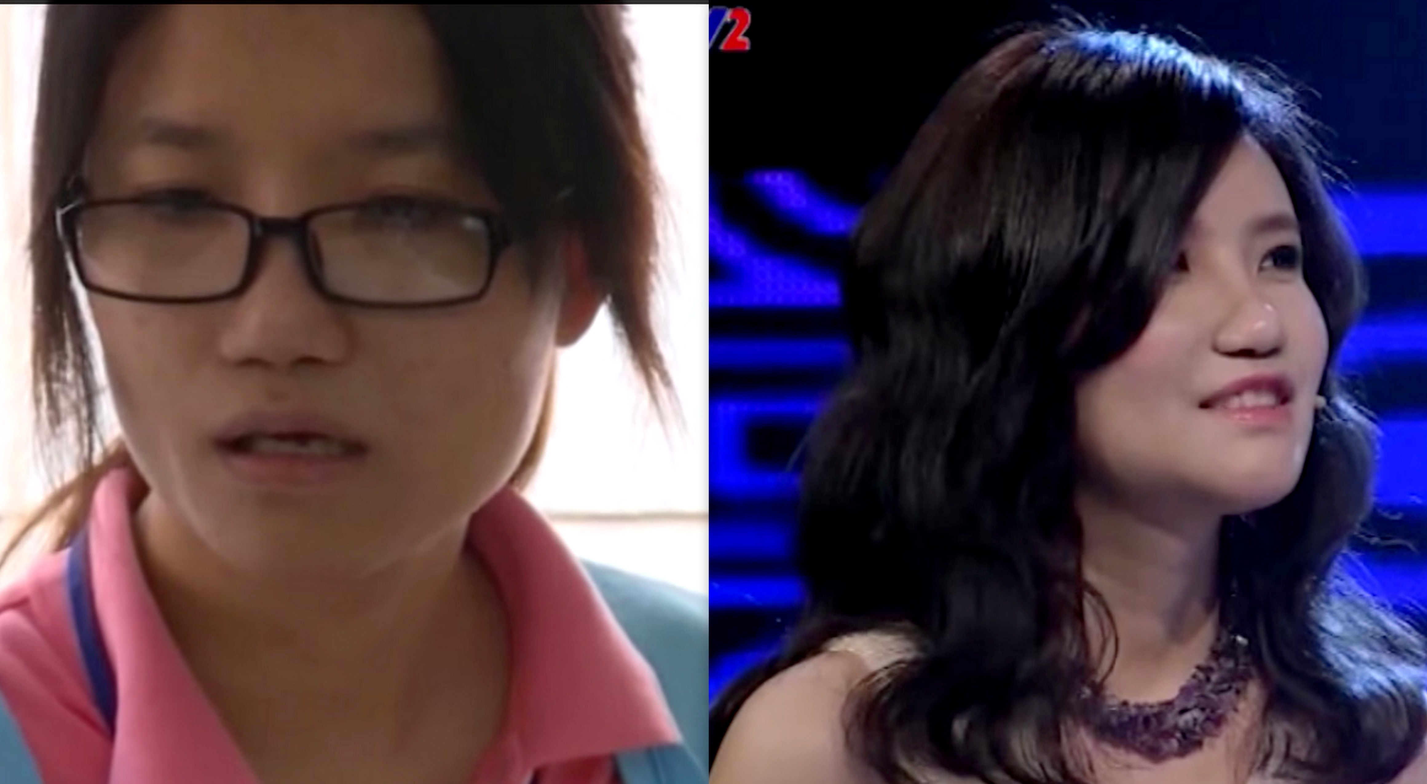 Nu sinh DH Bach khoa lot xac nho phau thuat tham my hinh anh