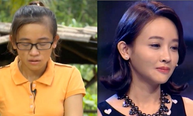 Thùy trước và sau khi tân trang nhan sắc.