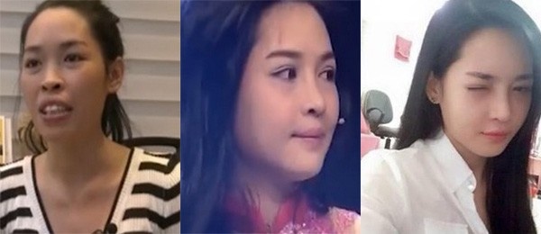 Thanh Quỳnh trước và sau phẫu thuật thẩm mỹ.