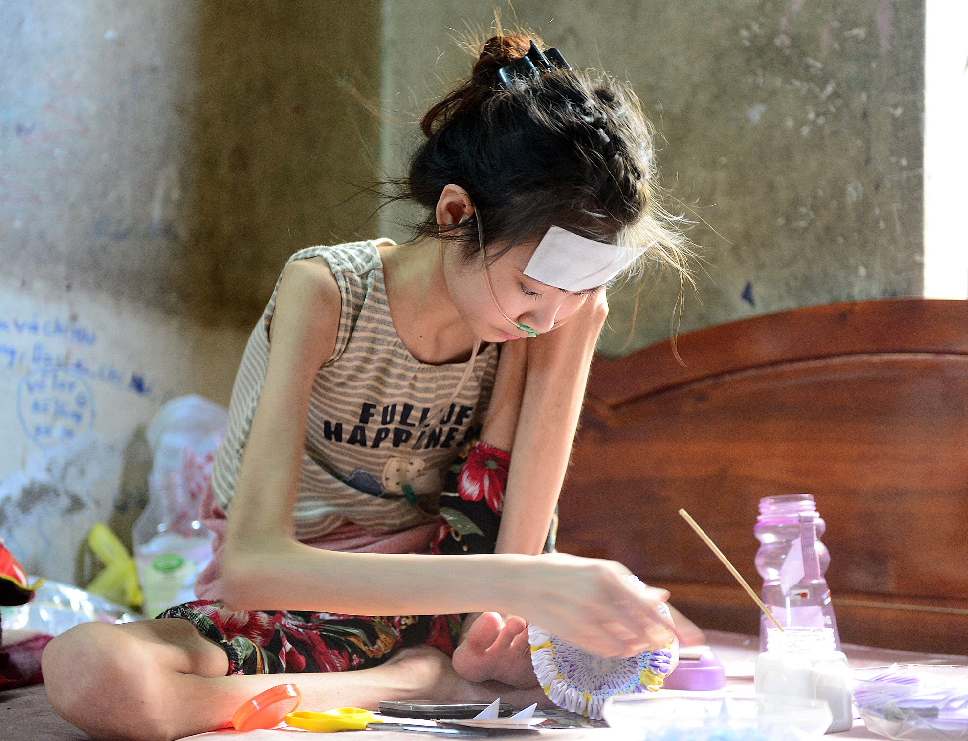 Gia tai hac giay cua co gai 17 tuoi mac benh quai ac hinh anh