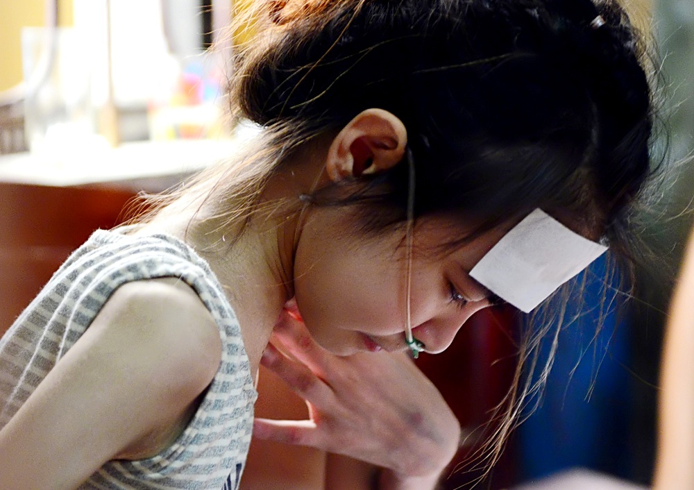 Cuoc song khon kho cua co be nang 20 kg, mac benh quai ac hinh anh