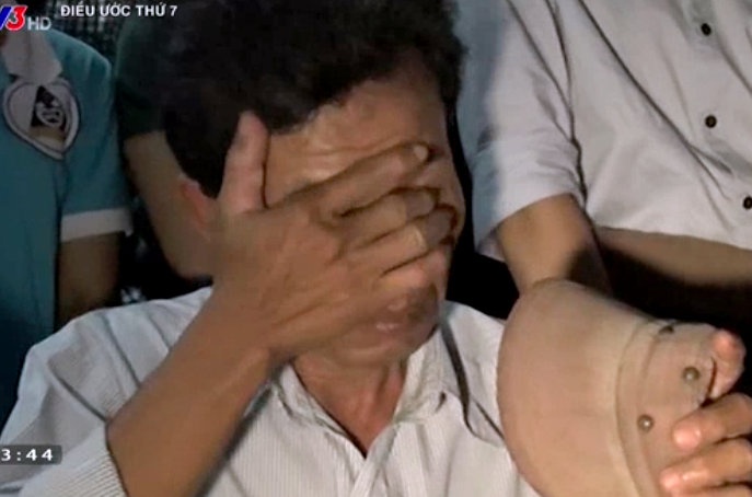 3 bo con xuc dong truoc vo kich tai hien hoan canh gia dinh hinh anh