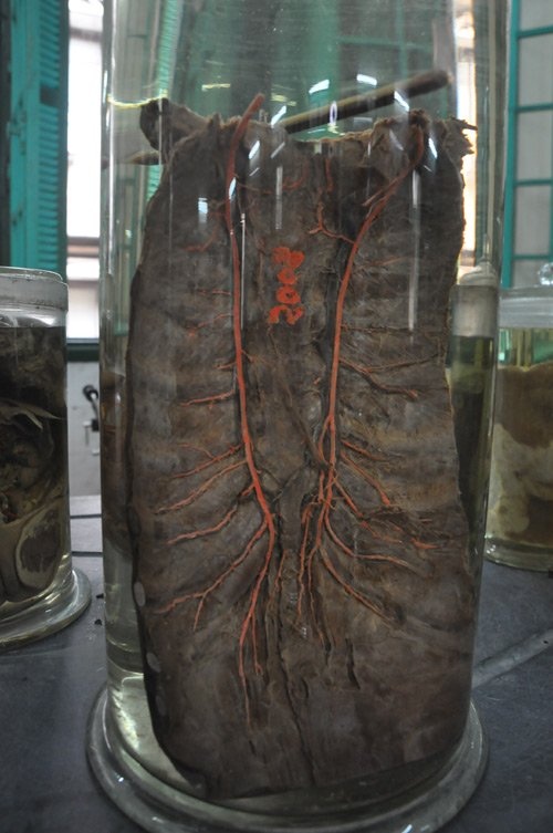 nha xac Dai hoc Y anh 6