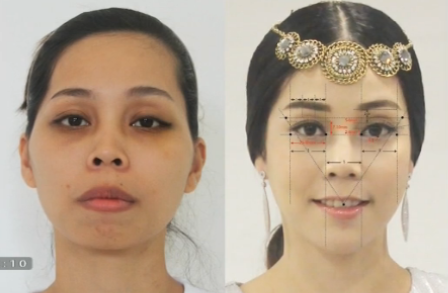 mẹ đơn thân phẫu thuật thẩm mỹ ảnh 1 me don than phau thuat tham my anh 1