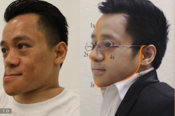phẫu thuật thẩm mỹ ảnh 2 phau thuat tham my anh 2