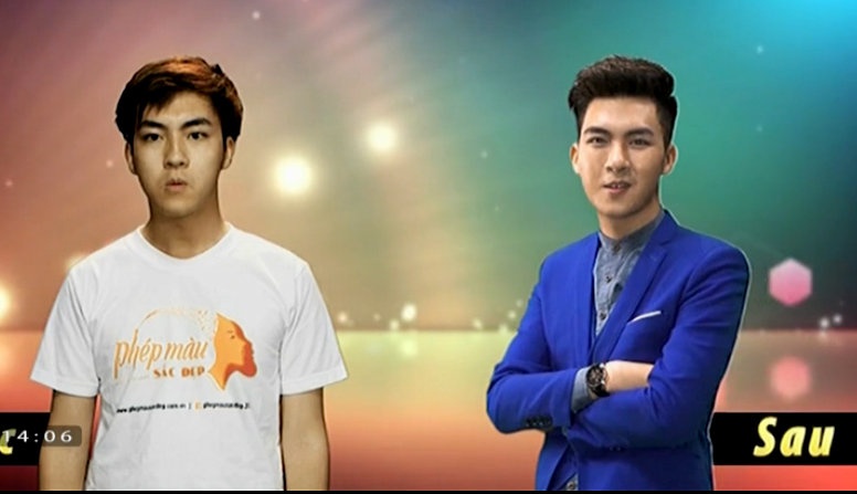 Hai Ninh thay doi sau phau thuat tham my hinh anh