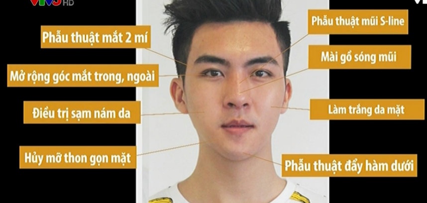 phẫu thuật thẩm mỹ ảnh 1 phau thuat tham my anh 1