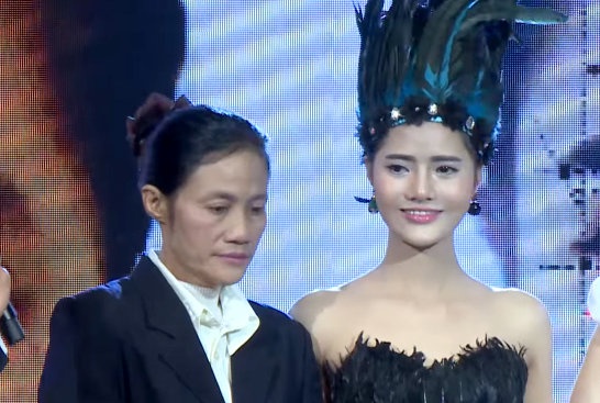 cô gái xinh đẹp nhờ phẫu thuật thẩm mỹ  ảnh 3 co gai xinh dep nho phau thuat tham my anh 3