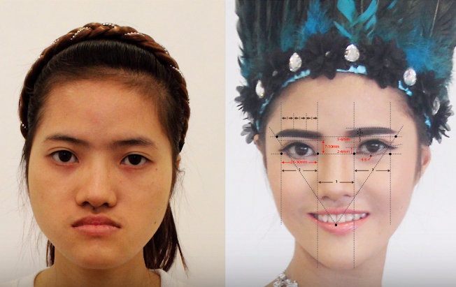 cô gái xinh đẹp nhờ phẫu thuật thẩm mỹ  ảnh 2 co gai xinh dep nho phau thuat tham my anh 2