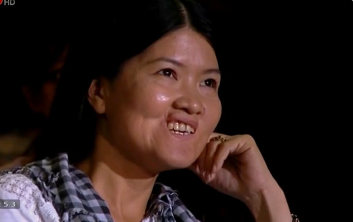 co gai xinh dep nho phau thuat tham my anh 1