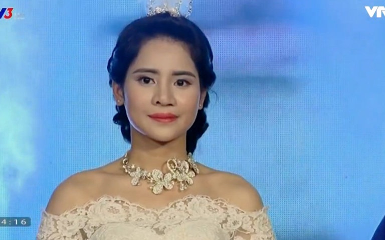 Nguyen Thi Thuong truoc va sau khi phau thuat tham my hinh anh